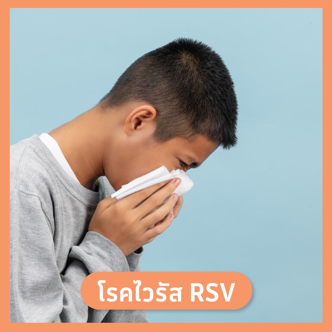 ไวรัส RSV