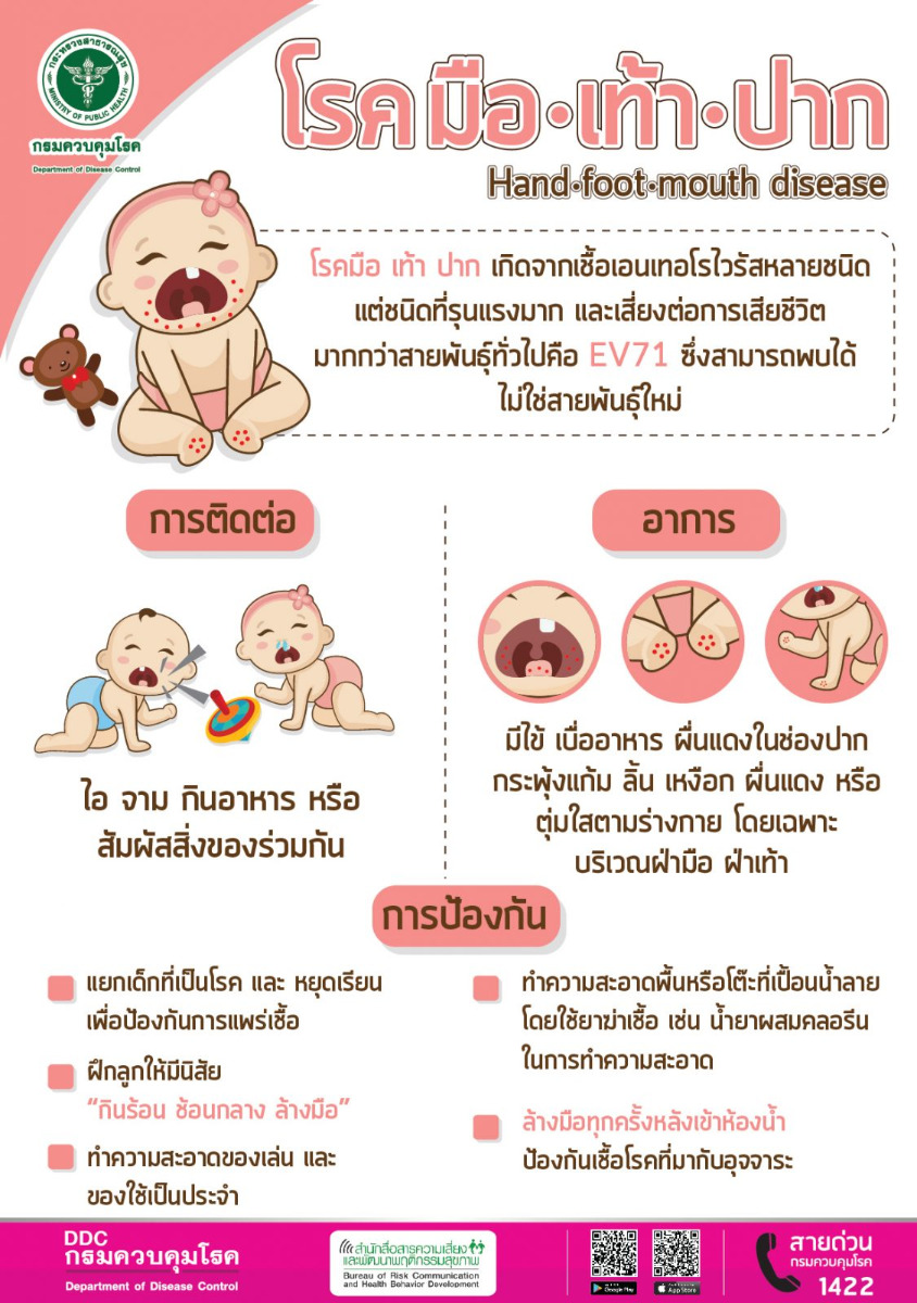 โรค มือ เท้า ปาก