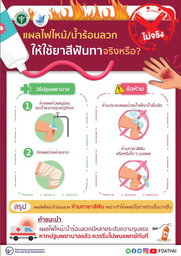 ยาสีฟัน แผลไฟไหม้ น้ำร้อนลวก