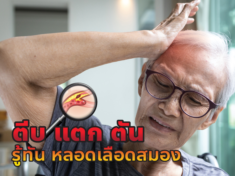 ตีบ ตัน แตก รู้ทันหลอดเลือดสมอง