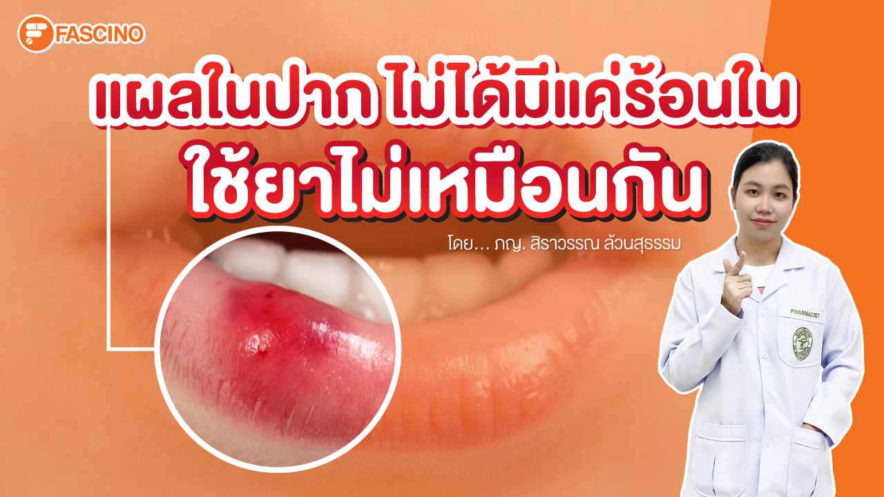4 สาเหตุการเกิดแผลในช่องปาก ต้องรักษาด้วยวิธีไหนถึงจะดี