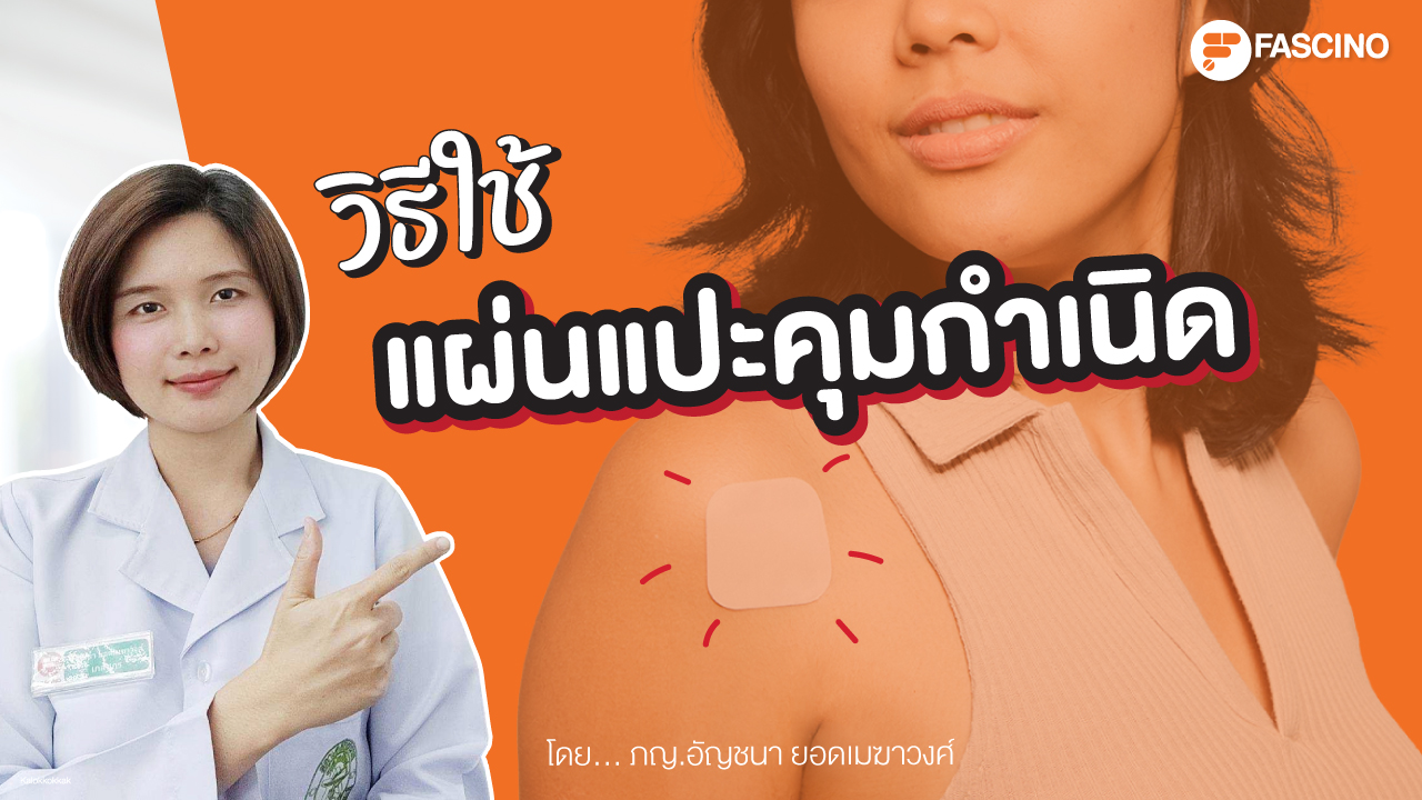 วิธีใช้ แผ่นแปะคุมกำเนิด