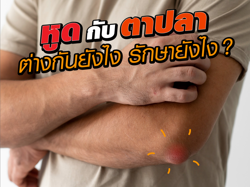 หูด กับ ตาปลา