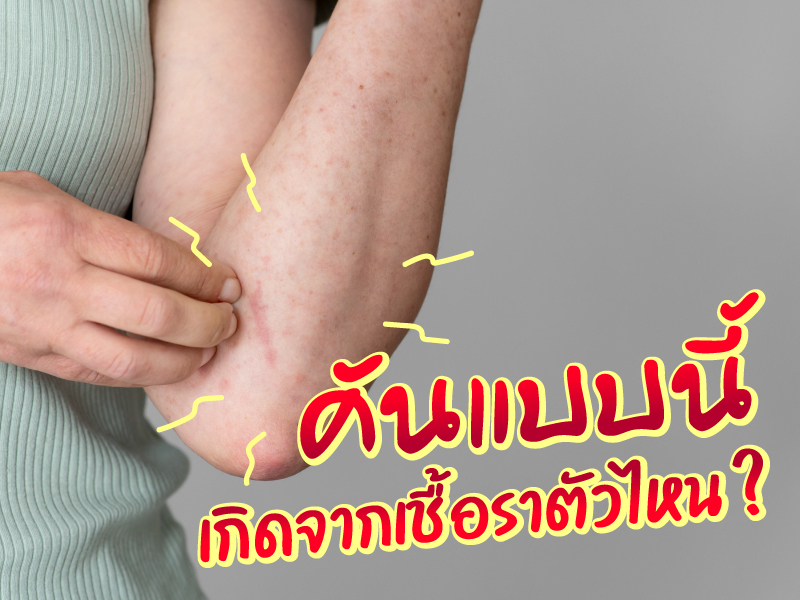 คันแบบนี้ เพราะเหตุใด