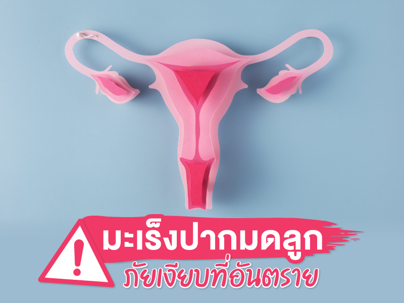 มะเร็งปากมดลูก ภัยเงียบที่สาว ๆ ไม่ควรมองข้าม !