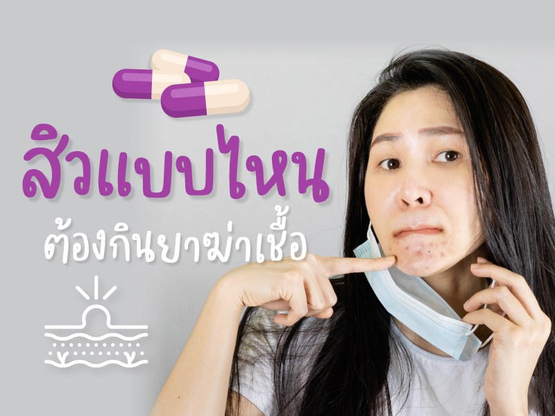สิวแบบไหนที่ต้องกินยาฆ่าเชื้อ ?
