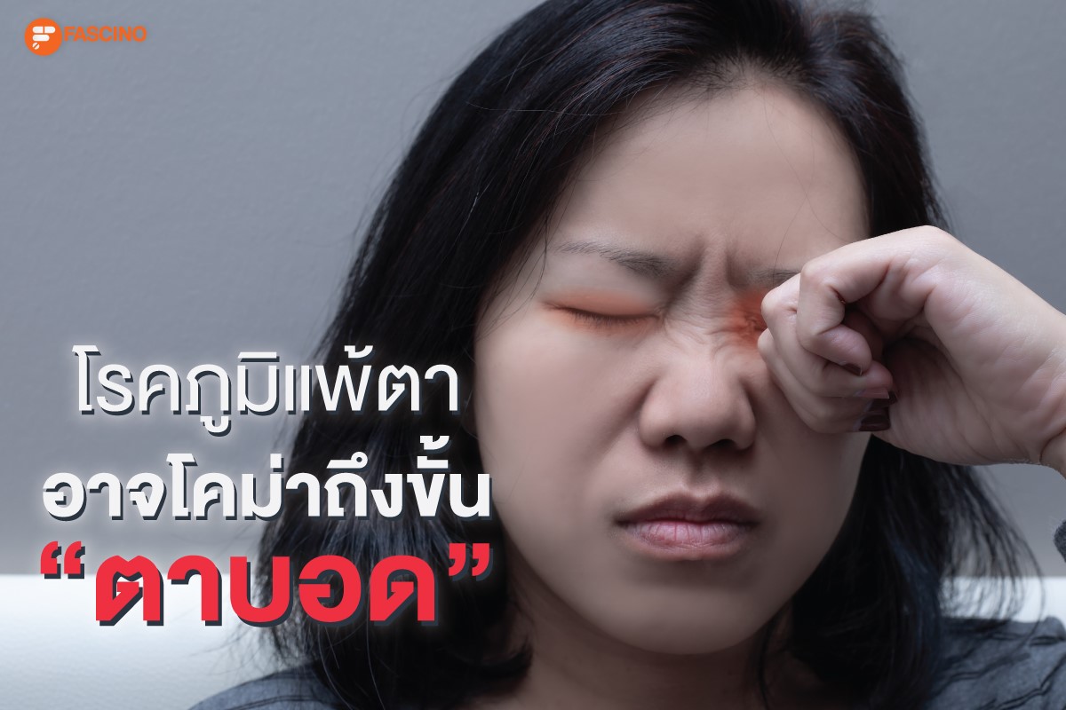 Allergic Pink Eye