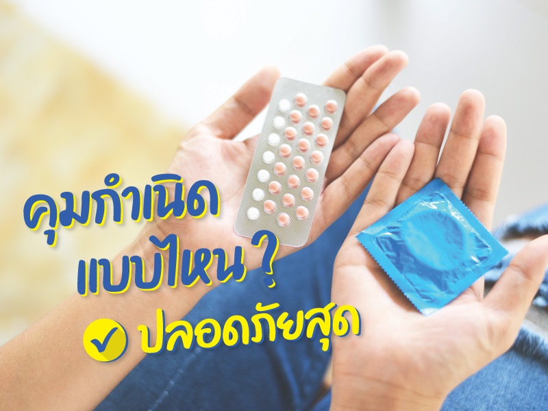 วิธี คุมกำเนิด ยอดนิยม