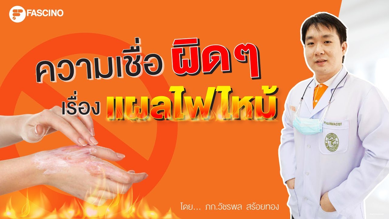 แผลไฟไหม้ ความเชื่อผิด