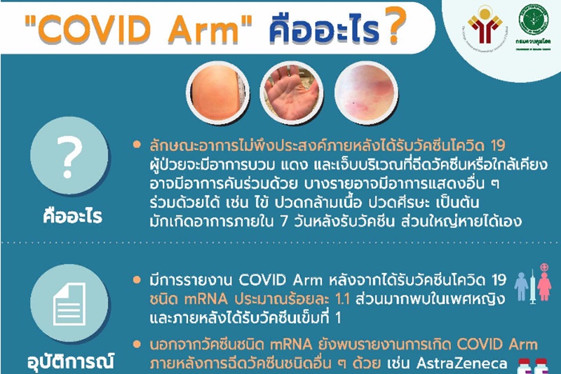 covid arm