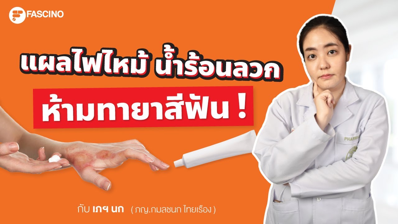 ยาสีฟัน รักษาแผลไฟไหม้ น้ำร้อนลวก ได้จริงไหม ?