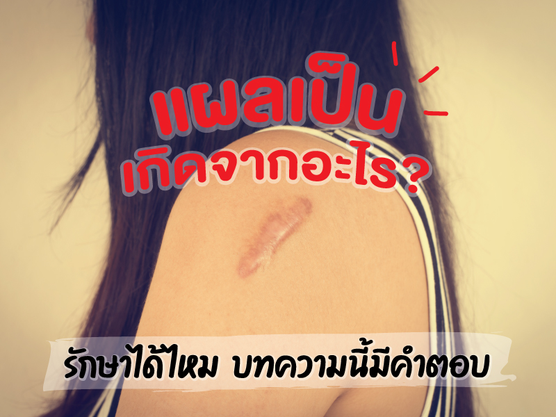 แผลเป็นเกิดจากอะไร