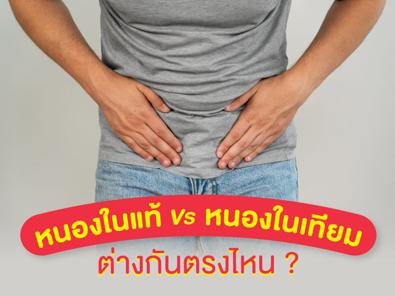 โรคหนองใน แท้ เทียม