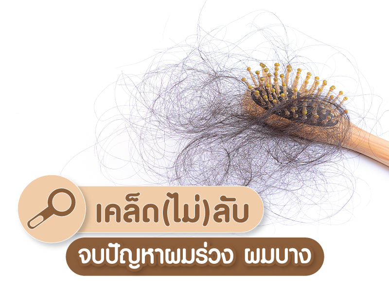 ปัญหาผมร่วง
