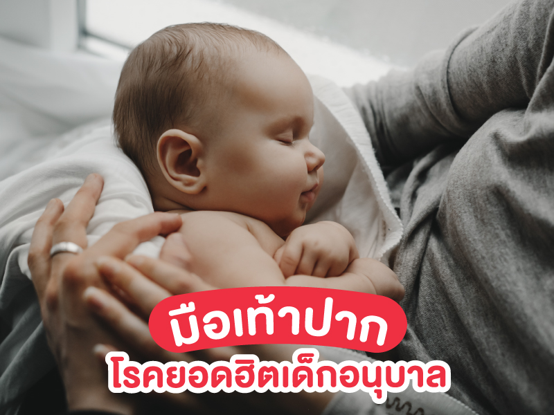 โรคมือเท้าปาก