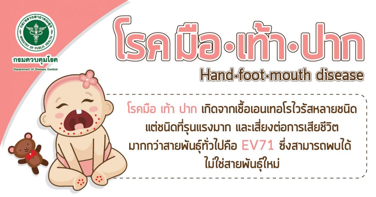 โรคมือเท้าปาก Hand Foot Mouth