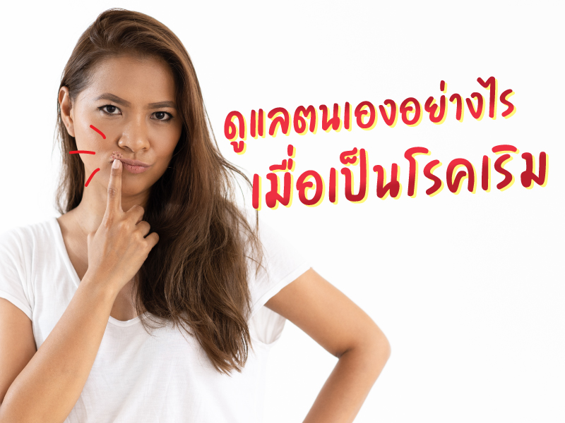 ดูแลตนเองอย่างไร เมื่อเป็นโรคเริม