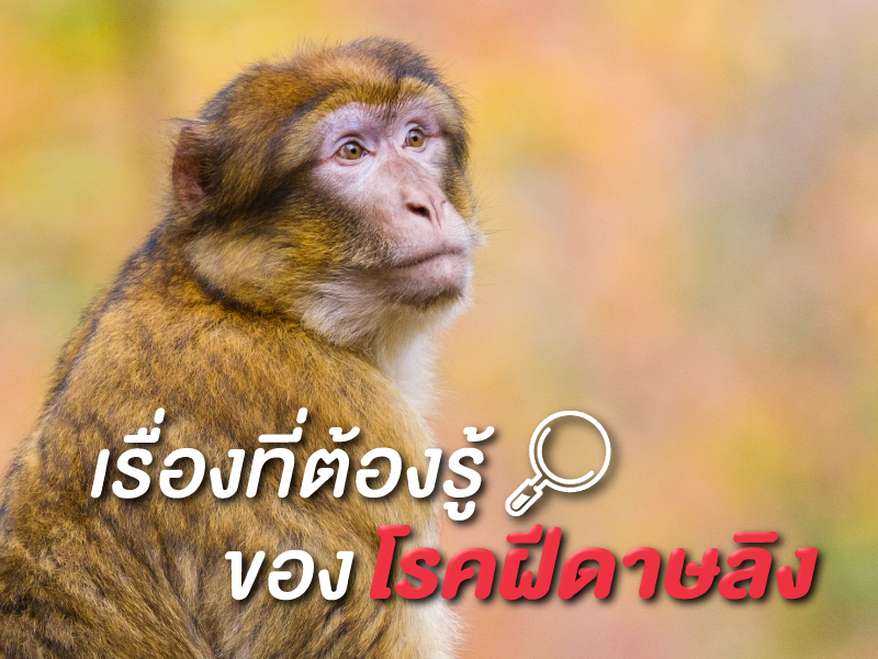 เรื่องที่ต้องรู้ของโรคฝีดาษลิง